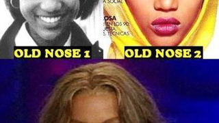 It's (Kinda) Settled: Tyra Banks Had A Nose Job